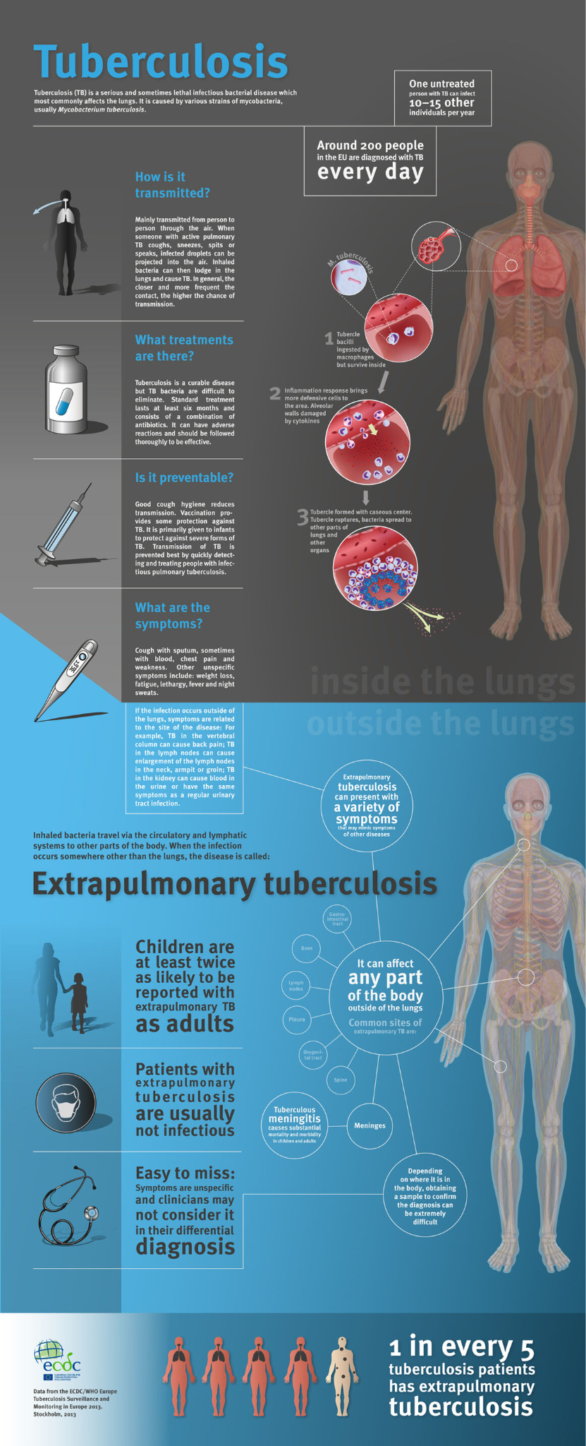 What is Extra Pulmonary Tuberculosis?_4.1